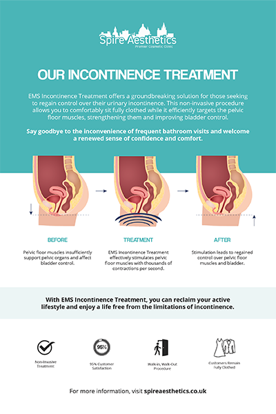 image to show how EMS treatment works for female urinary incontinence Baillieston